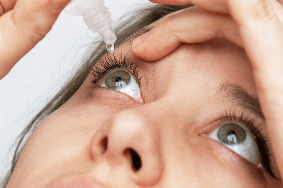 Illustration of woman dropping liquid onto eye